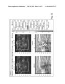 MULTI-LAYER COATING FOR OPTOACOUSTIC PROBE diagram and image