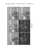 MULTI-LAYER COATING FOR OPTOACOUSTIC PROBE diagram and image