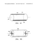 SUBCUTANEOUS CAVITY MARKING DEVICE AND METHOD diagram and image