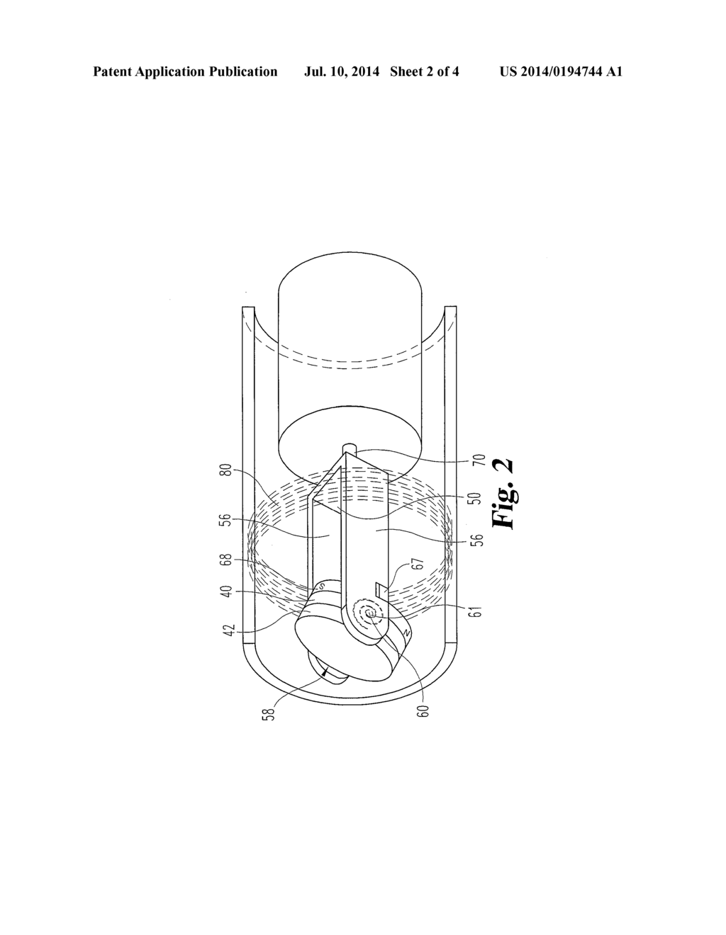 ULTRASOUND TRANSDUCER DIRECTION CONTROL - diagram, schematic, and image 03