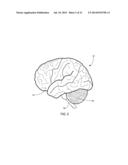 SYSTEM AND METHOD FOR EVALUATING AN ELECTROPHYSIOLOGICAL SIGNAL diagram and image