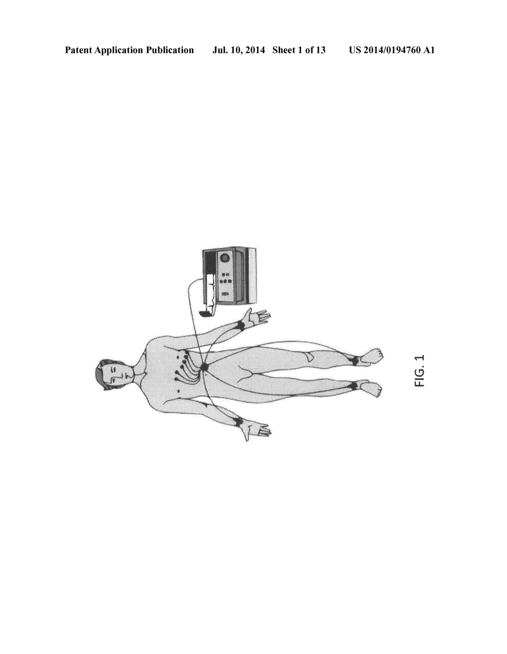 METHODS AND SYSTEMS FOR ELECTRODE PLACEMENT - diagram, schematic, and image 02