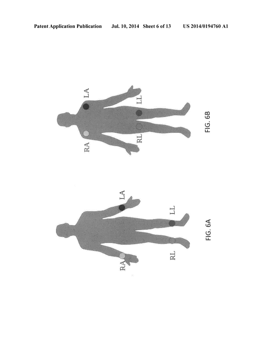 METHODS AND SYSTEMS FOR ELECTRODE PLACEMENT - diagram, schematic, and image 07