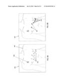 METHODS AND SYSTEMS FOR ELECTRODE PLACEMENT diagram and image