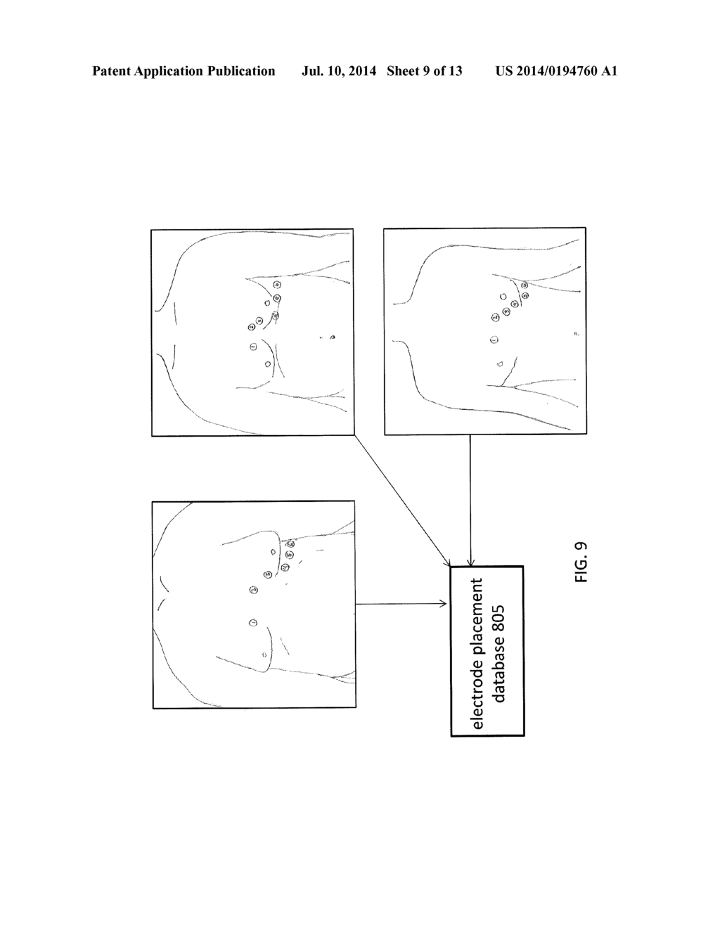 METHODS AND SYSTEMS FOR ELECTRODE PLACEMENT - diagram, schematic, and image 10