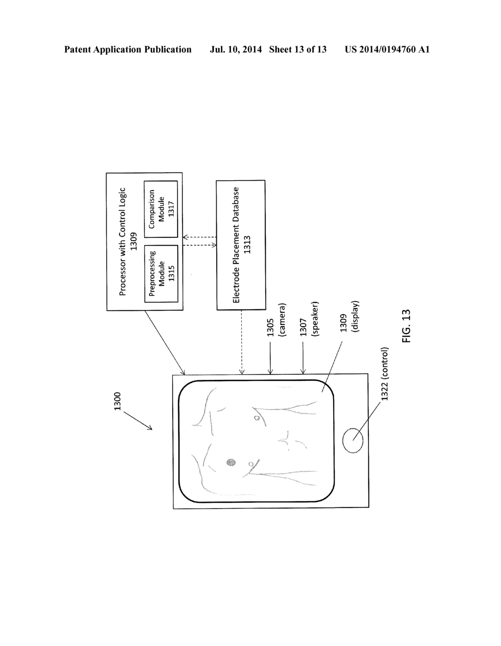 METHODS AND SYSTEMS FOR ELECTRODE PLACEMENT - diagram, schematic, and image 14