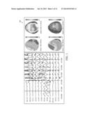 Method And System To Calculate  qEEG diagram and image