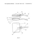 PHOTOTHERMAL TREATMENT OF SOFT TISSUES diagram and image