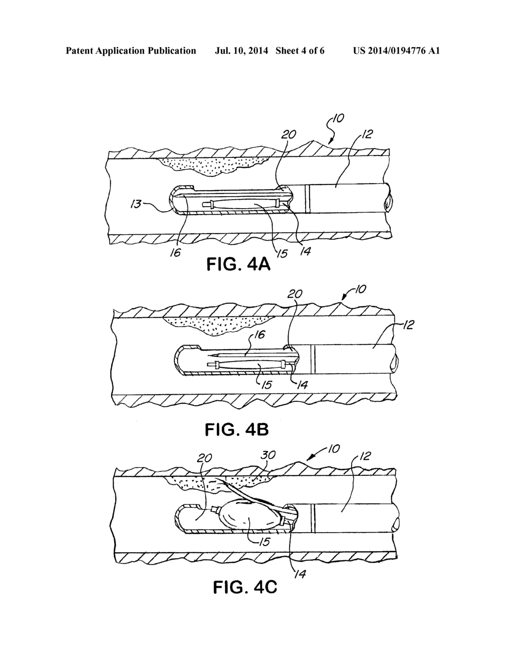 Precision Directed Medical Instruments - diagram, schematic, and image 05