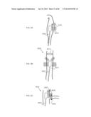 METHODS AND DEVICES FOR THERMALLY INDUCED HEPATIC NEUROMODULATION diagram and image