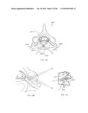 METHODS AND DEVICES FOR THERMALLY INDUCED HEPATIC NEUROMODULATION diagram and image