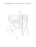 METHODS AND DEVICES FOR THERMALLY INDUCED HEPATIC NEUROMODULATION diagram and image