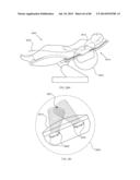 METHODS AND DEVICES FOR THERMALLY INDUCED HEPATIC NEUROMODULATION diagram and image