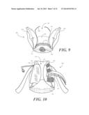 Heel Protector and Corresponding Rehabilitation Systems and Methods for     Using the Same diagram and image