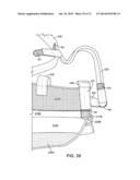 Reconfigurable Shoulder and Arm Orthosis and Method diagram and image