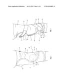 ORTHOPEDIC DEVICE AND METHOD FOR SECURING THE SAME diagram and image