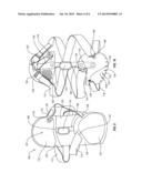 ORTHOPEDIC DEVICE AND METHOD FOR SECURING THE SAME diagram and image