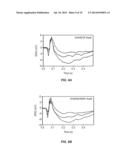 Auto-Regulation System for Intraocular Pressure diagram and image