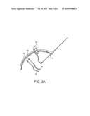 SYSTEM FOR ACL RECONSTRUCTION USING RETROGRADE CUTTER diagram and image