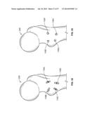 FIXATION SYSTEMS AND METHODS diagram and image