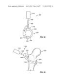 FIXATION SYSTEMS AND METHODS diagram and image