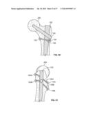 FIXATION SYSTEMS AND METHODS diagram and image