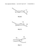 FIXATION SYSTEMS AND METHODS diagram and image