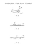 FIXATION SYSTEMS AND METHODS diagram and image