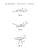 FIXATION SYSTEMS AND METHODS diagram and image