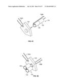 FIXATION SYSTEMS AND METHODS diagram and image