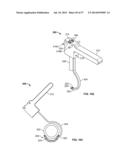 FIXATION SYSTEMS AND METHODS diagram and image