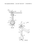 FIXATION SYSTEMS AND METHODS diagram and image