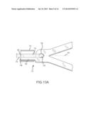 CONNECTION OF AN ENDOVASCULAR INTERVENTION DEVICE TO A MANIPULATION MEMBER diagram and image