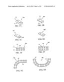 DEVICES AND METHODS FOR STABILIZING TISSUE AND IMPLANTS diagram and image