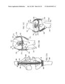 DEVICES AND METHODS FOR STABILIZING TISSUE AND IMPLANTS diagram and image