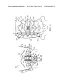 DEVICES AND METHODS FOR STABILIZING TISSUE AND IMPLANTS diagram and image