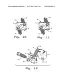 Intervertebral Fusion Implant diagram and image