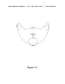 FLEXIBLE MEDIUM COVERAGE FACE MASK diagram and image