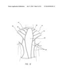 Sensory Motor Stimulation Garments and Methods diagram and image