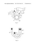 Wheel Axle Suspension diagram and image