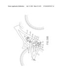 Rail Suspension With Integral Shock And Dampening Mechanism diagram and image