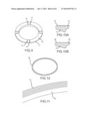 ELECTRIC MOTOR ROTOR THERMAL INTERFACE WITH AXIAL HEAT SINKS diagram and image