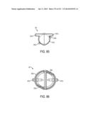 BLOOD TREATMENT SYSTEMS AND METHODS diagram and image