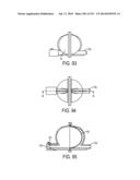 BLOOD TREATMENT SYSTEMS AND METHODS diagram and image