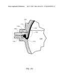 BLOOD TREATMENT SYSTEMS AND METHODS diagram and image