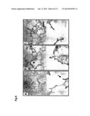 USE OF TGF-BETA ANTAGONISTS TO TREAT INFANTS AT RISK OF DEVELOPING     BRONCHOPULMONARY DYSPLASIA diagram and image