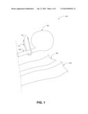 TRANS-URETHRAL SLING DELIVERY DEVICE diagram and image