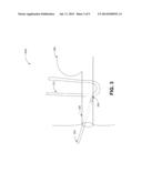 TRANS-URETHRAL SLING DELIVERY DEVICE diagram and image