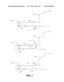 TRANS-URETHRAL SLING DELIVERY DEVICE diagram and image