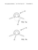 POSITIONAL STABILIZATION AND SECUREMENT COUPLING ATTACHMENT FOR USE IN     LAPAROSCOPIC SURGERY AND METHOD OF USE diagram and image